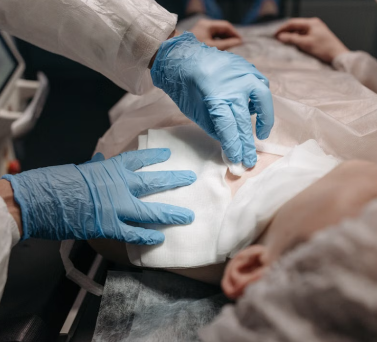 Advanced Burn Wound Management